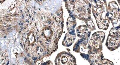 Immunohistochemistry-Paraffin: VEGF-D Antibody (MM0007-7E79) - Azide and BSA Free [NB110-60973]