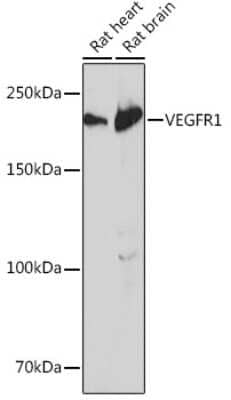 Western Blot: VEGFR1/Flt-1 Antibody (7F1A3) [NBP3-15683]