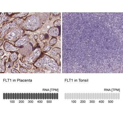 Immunohistochemistry-Paraffin: VEGFR1/Flt-1 Antibody (CL0344) [NBP2-52919]