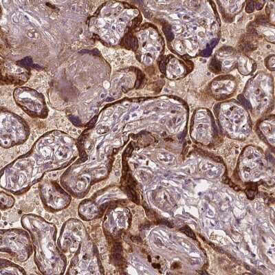 Immunohistochemistry-Paraffin: VEGFR1/Flt-1 Antibody (CL0345) [NBP2-30982]