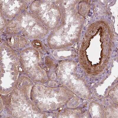 Immunohistochemistry-Paraffin: VEGFR1/Flt-1 Antibody (CL0345) [NBP2-30982]