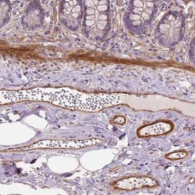 Immunohistochemistry-Paraffin: VEGFR1/Flt-1 Antibody (CL0345) [NBP2-30982]