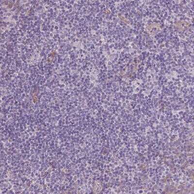 Immunohistochemistry-Paraffin: VEGFR1/Flt-1 Antibody (CL0345) [NBP2-30982]