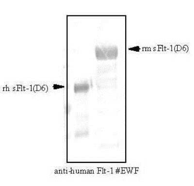 Western Blot: VEGFR1/Flt-1 Antibody (EWF)Azide and BSA Free [NB600-1006]