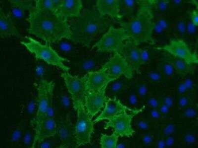 Immunocytochemistry/ Immunofluorescence: VEGFR1/Flt-1 Antibody (EWC) - Azide and BSA Free [NB600-1004]