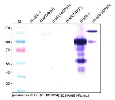 Western Blot: VEGFR1/Flt-1 Antibody (EWC)Azide and BSA Free [NB600-1004]