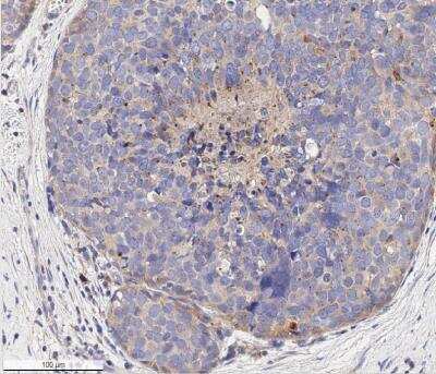 Immunohistochemistry-Paraffin: VEGFR1/Flt-1 Antibody [NB100-527]