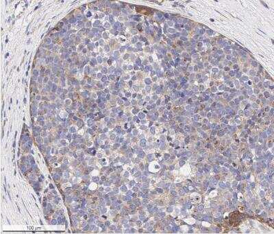 Immunohistochemistry-Paraffin: VEGFR1/Flt-1 Antibody [NB100-527]