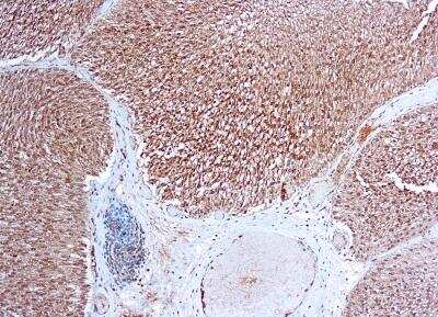 Immunohistochemistry-Paraffin: VEGFR1/Flt-1 Antibody [NB100-685]