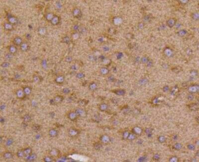 Immunohistochemistry-Paraffin: VEGFR1/Flt-1 Antibody (SY09-09) [NBP3-11864]