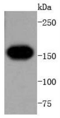 Western Blot: VEGFR1/Flt-1 Antibody (SY09-09) [NBP3-11864]