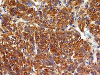 Immunohistochemistry-Paraffin: VEGFR2/KDR/Flk-1 Antibody (1B6) - Azide and BSA Free [NBP2-81008]