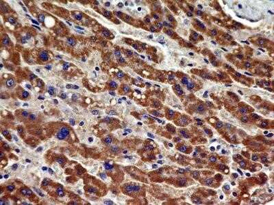 Immunohistochemistry-Paraffin: VEGFR2/KDR/Flk-1 Antibody (1B6) - Azide and BSA Free [NBP2-81008]