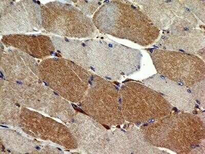 Immunohistochemistry-Paraffin: VEGFR2/KDR/Flk-1 Antibody (1B6) - Azide and BSA Free [NBP2-81008]