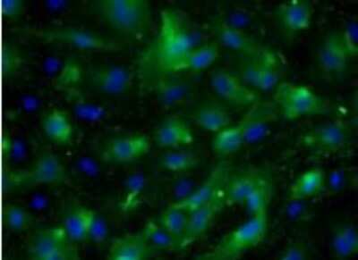 Immunocytochemistry/ Immunofluorescence: VEGFR2/KDR/Flk-1 Antibody (20I6) - Azide and BSA Free [NBP1-18646]