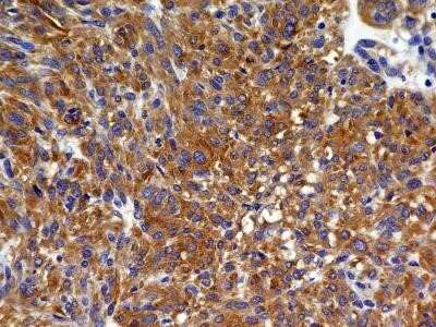 Immunohistochemistry: VEGFR2/KDR/Flk-1 Antibody (2C6) - Azide and BSA Free [NBP2-81009]