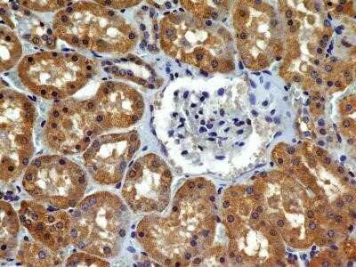 Immunohistochemistry-Paraffin: VEGFR2/KDR/Flk-1 Antibody (2C6) - Azide and BSA Free [NBP2-81009]