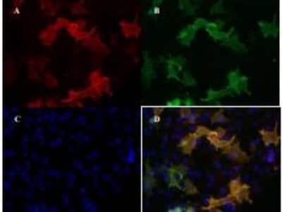 Immunocytochemistry/ Immunofluorescence: VEGFR2/KDR/Flk-1 Antibody (4H3) - Azide and BSA Free [NBP1-18644]