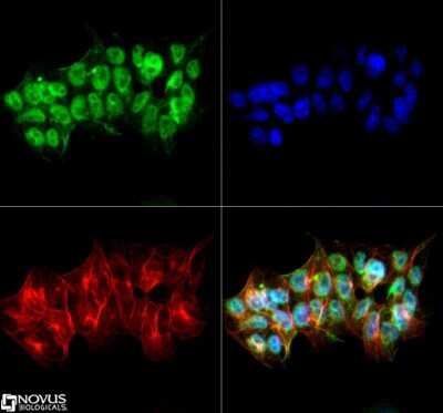 Immunocytochemistry/ Immunofluorescence: VEGFR2/KDR/Flk-1 Antibody [NB100-530]