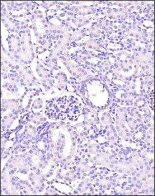 Immunohistochemistry-Paraffin: VEGFR2/KDR/Flk-1 Antibody - BSA Free [NBP3-05772]