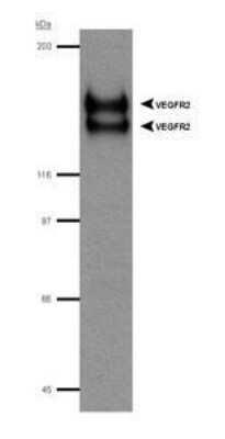 Western Blot: VEGFR2/KDR/Flk-1 Antibody [NB100-530]