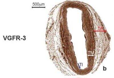 Immunohistochemistry: VEGFR3/Flt-4 Antibody (9D9) - Azide and BSA Free [NBP1-18651]