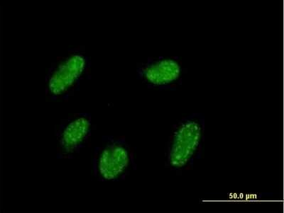 Immunocytochemistry/ Immunofluorescence: VENTX Antibody [H00027287-B01P]