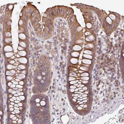 Immunohistochemistry-Paraffin: VENTX Antibody [NBP2-30751]