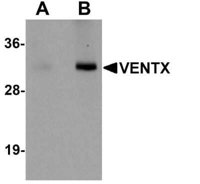 Western Blot: VENTX AntibodyBSA Free [NBP1-77192]