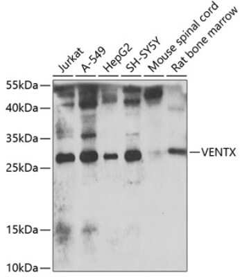 Western Blot: VENTX AntibodyBSA Free [NBP2-93130]