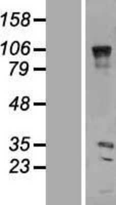 Western Blot: VENTX Overexpression Lysate [NBP2-07327]