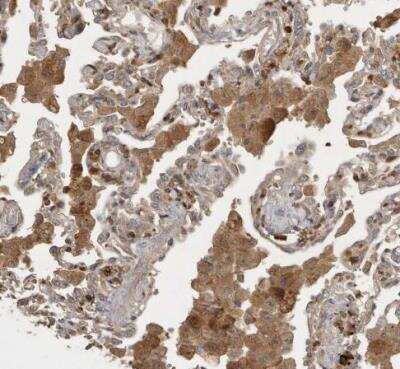 Immunohistochemistry-Paraffin: VEPH1 Antibody [NBP1-82291]