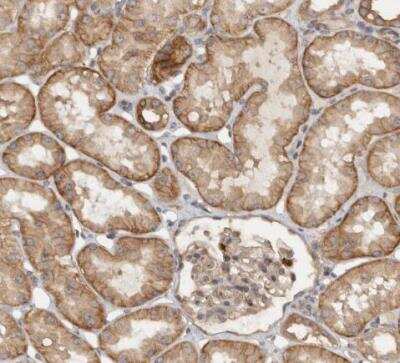 Immunohistochemistry-Paraffin: VEPH1 Antibody [NBP1-82291]