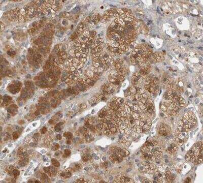Immunohistochemistry-Paraffin: VEPH1 Antibody [NBP1-82291]