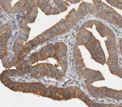 Immunohistochemistry-Paraffin: VEPH1 Antibody [NBP1-82291]