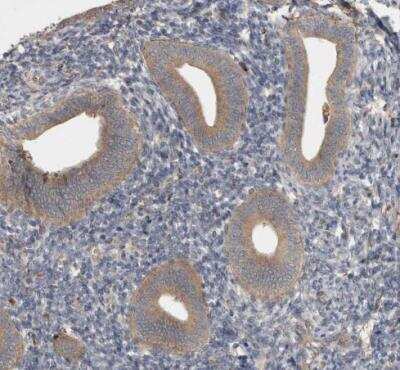 Immunohistochemistry-Paraffin: VEPH1 Antibody [NBP1-82291]