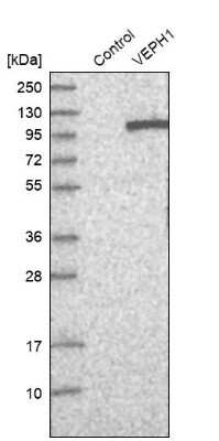 Western Blot: VEPH1 Antibody [NBP1-82291]