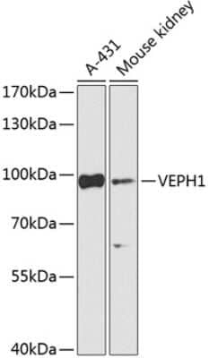 Western Blot: VEPH1 AntibodyBSA Free [NBP2-94600]