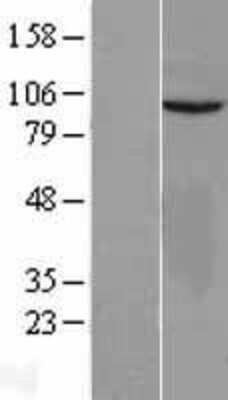 Western Blot: VEPH1 Overexpression Lysate [NBL1-17715]