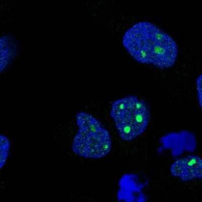 Immunocytochemistry/ Immunofluorescence: VEST1 Antibody [NBP2-55670]