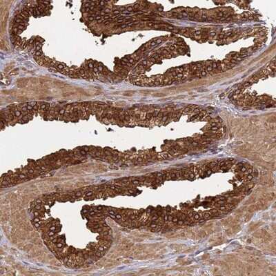 Immunohistochemistry-Paraffin: VEST1 Antibody [NBP1-92571]