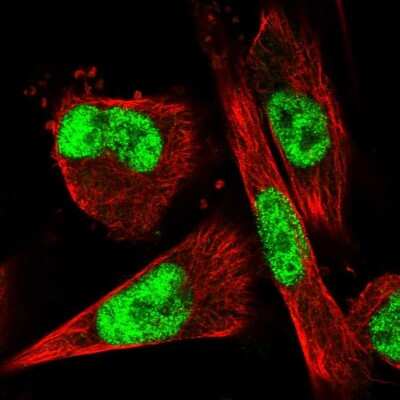 Immunocytochemistry/ Immunofluorescence: VEZF1 Antibody [NBP1-84301]