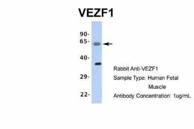 Western Blot: VEZF1 Antibody [NBP1-80115]