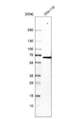 Western Blot: VEZF1 Antibody [NBP1-84301]