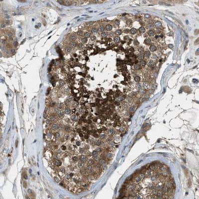 Immunohistochemistry-Paraffin: VEZT Antibody [NBP1-85039]