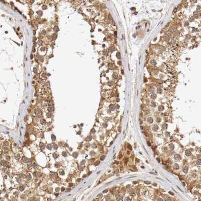 Immunohistochemistry-Paraffin: VEZT Antibody [NBP1-85040]