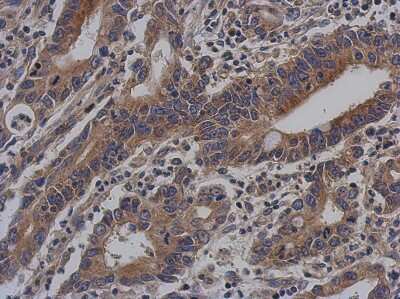 Immunohistochemistry-Paraffin: VEZT Antibody [NBP2-20855]