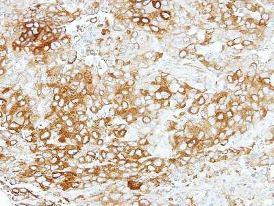 Immunohistochemistry-Paraffin: VEZT Antibody [NBP2-20856]