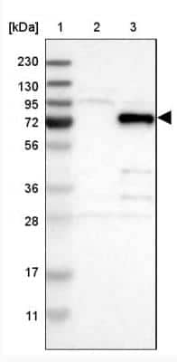 Western Blot: VEZT Antibody [NBP1-85039]