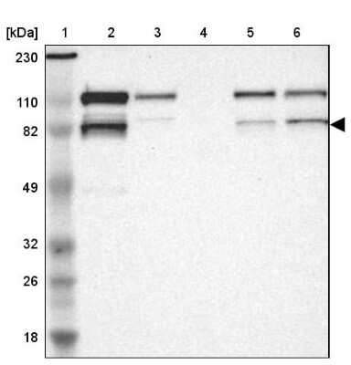 Western Blot: VEZT Antibody [NBP1-85040]